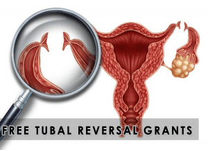 Free Tubal Reversal Grants